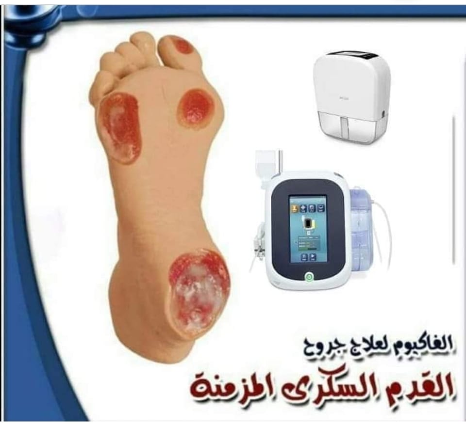 جهاز الفاكيوم
